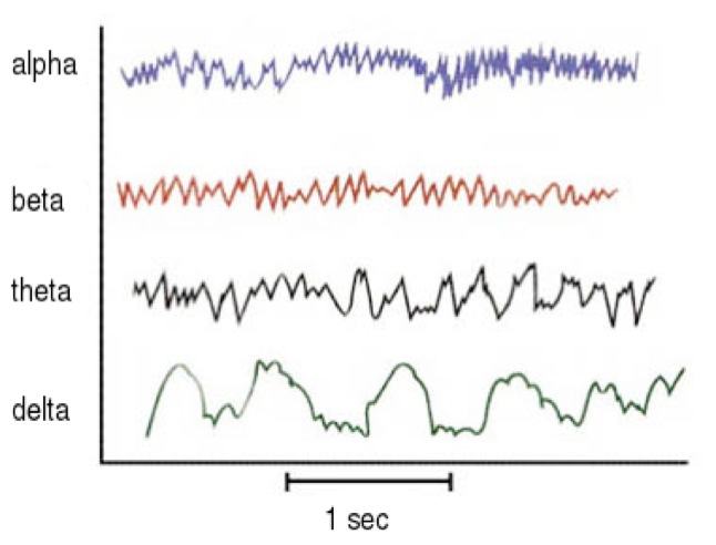 brain_waves